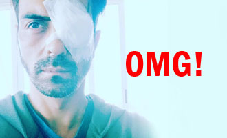 OH NO! Arjun Rampal injures his eye