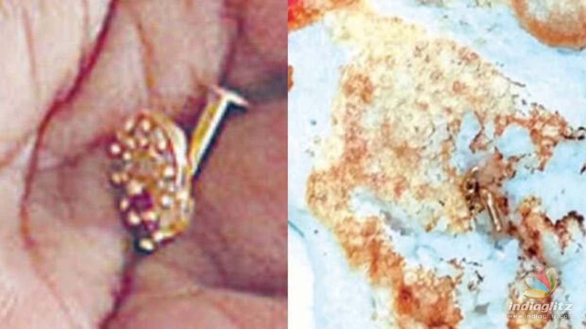 Popular TV serial  actress finds gold nose ring inside dosa batter
