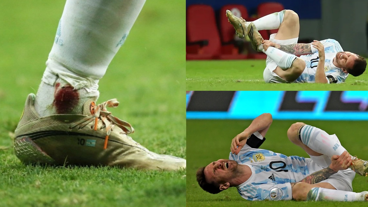 Lionel Messi plays with a bleeding ankle during Copa America semi-final ...