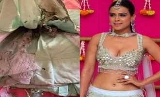 TV actress's dress catches fire during Diwali dance