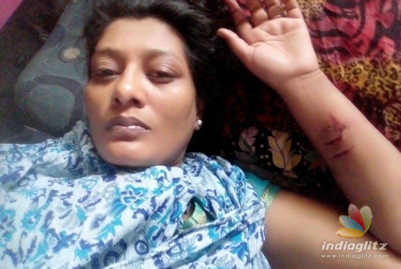 Actress Nilani releases evidence of her lover torturing her