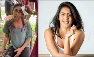 Shocking video of actress Samyuktha Hegde's freak accident goes viral