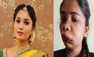 Shocking! Actress Swathi Sathish face disfigured after wrong medical procedure thumbnail