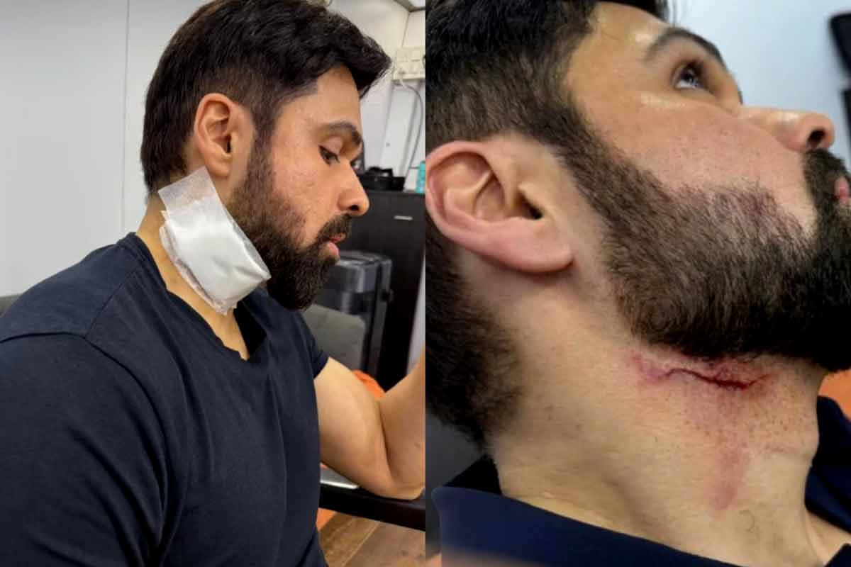 Emraan Hashmi injured while enacting stunts for Goodachari 2