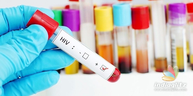HIV-related deaths on the decline: Report