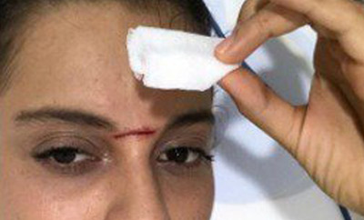 Kangana injures herself on 'Manikarnika' set