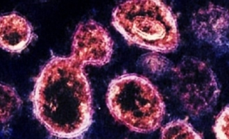 New virus Animal derived Langya henipavirus found in China