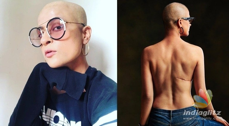 Tahira posts backless pic, says scars are badges of honour